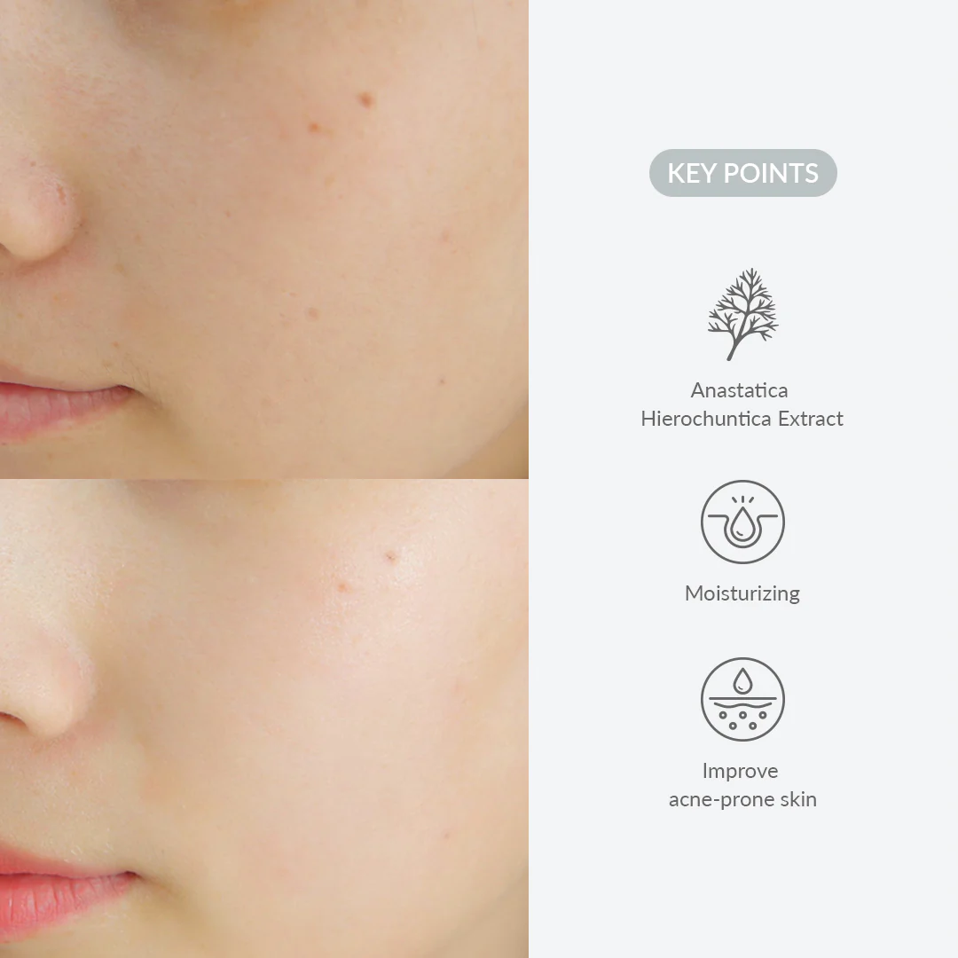 Dr. Althea – Last Minute Skin Rescue Anastatica Mask(30pcs)