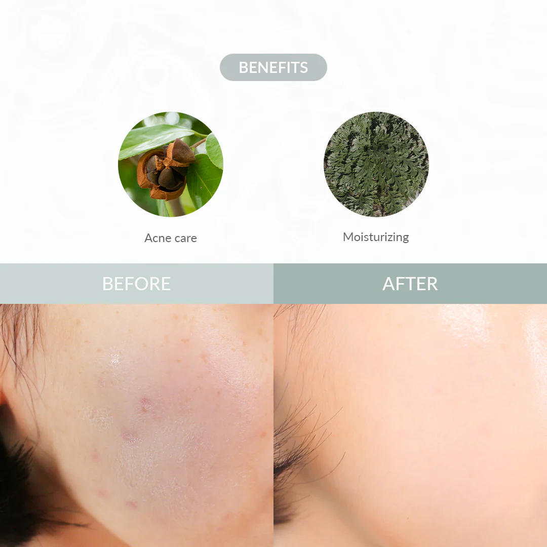 Dr. Althea – Last Minute Skin Rescue Anastatica Mask(30pcs)