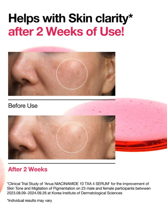 Anua - Niacinamide 10% + TXA 4% Serum