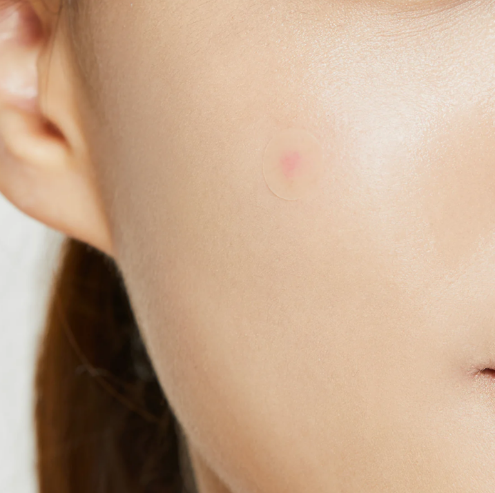 COSRX Acne Pimple Master Patches