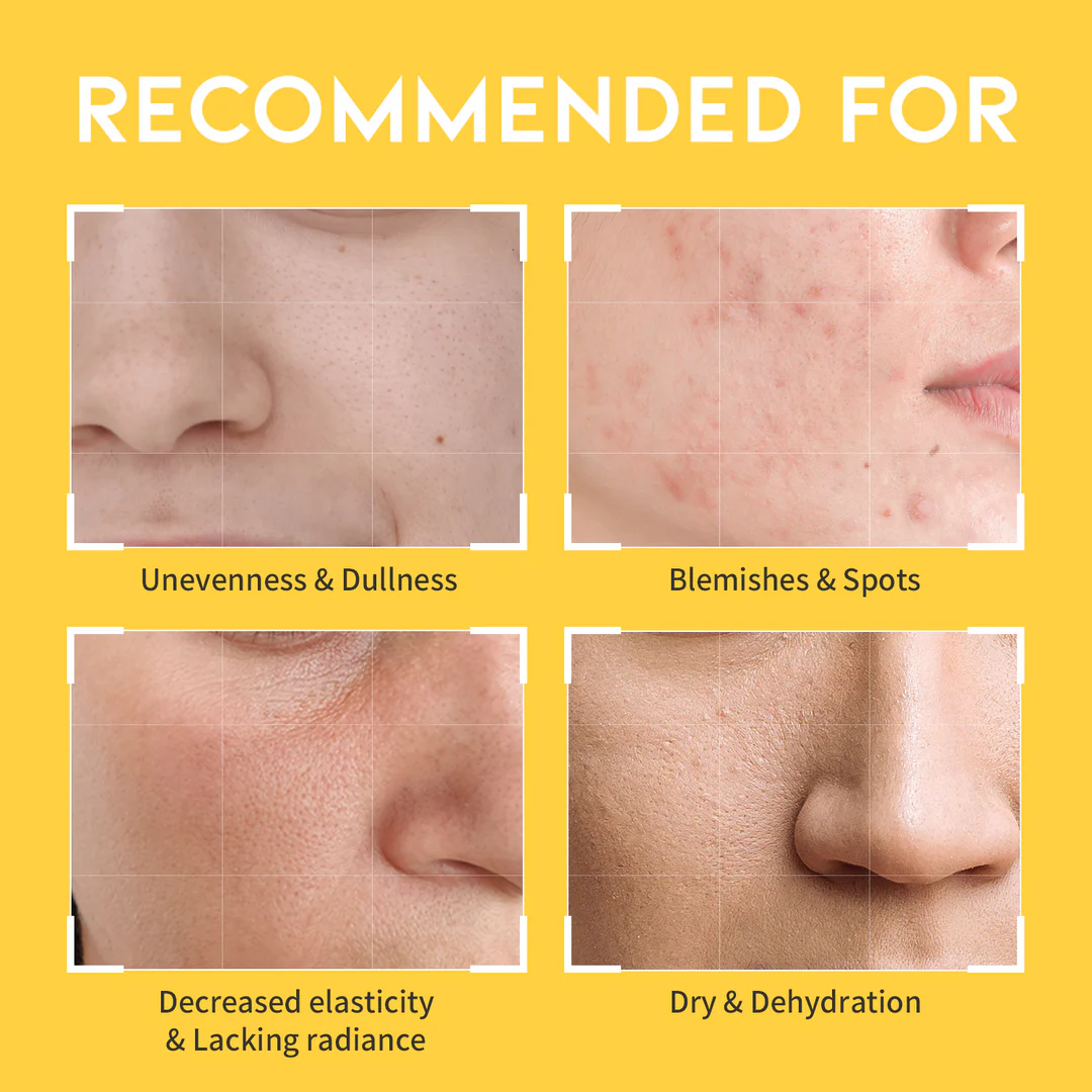 OOTD – Dark Spot Vitamin C Toner (250 ml)