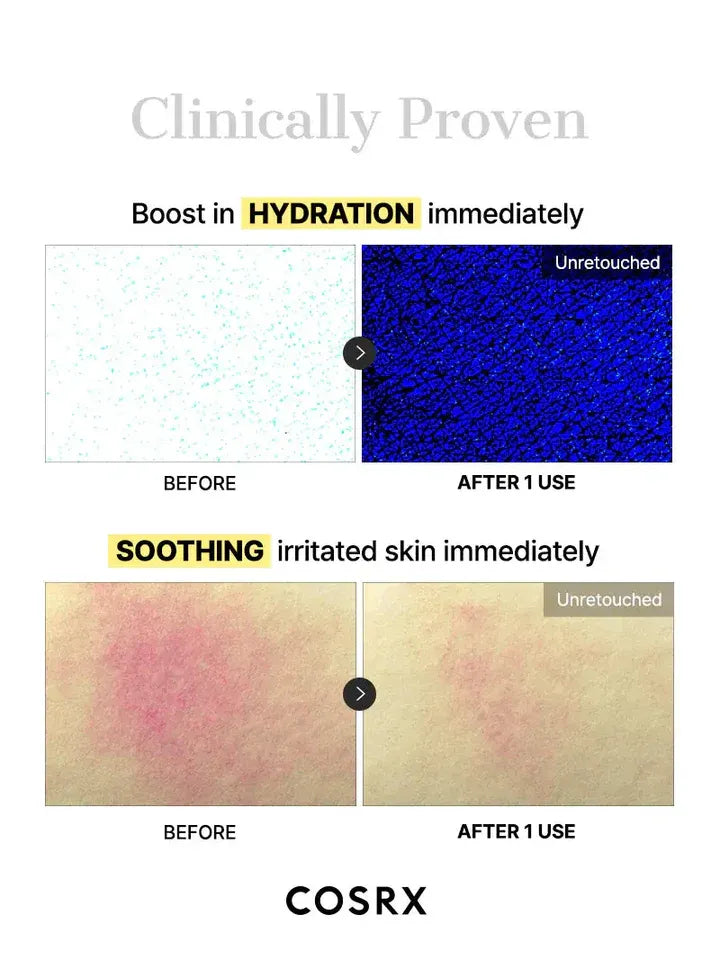 COSRX – Advanced Snail Mucin Glass Glow Hydrogel Mask 3-Pack