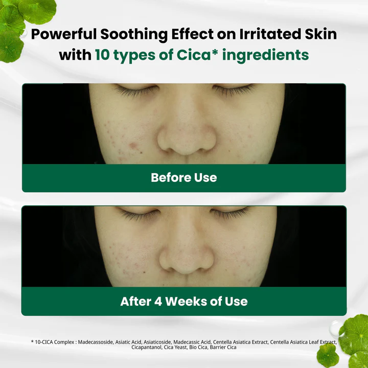 Dr.G – R.E.D Blemish Clear Soothing Cream (70 ml)