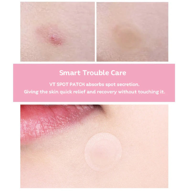 VT Cosmetics – Spot Patch (48ea)