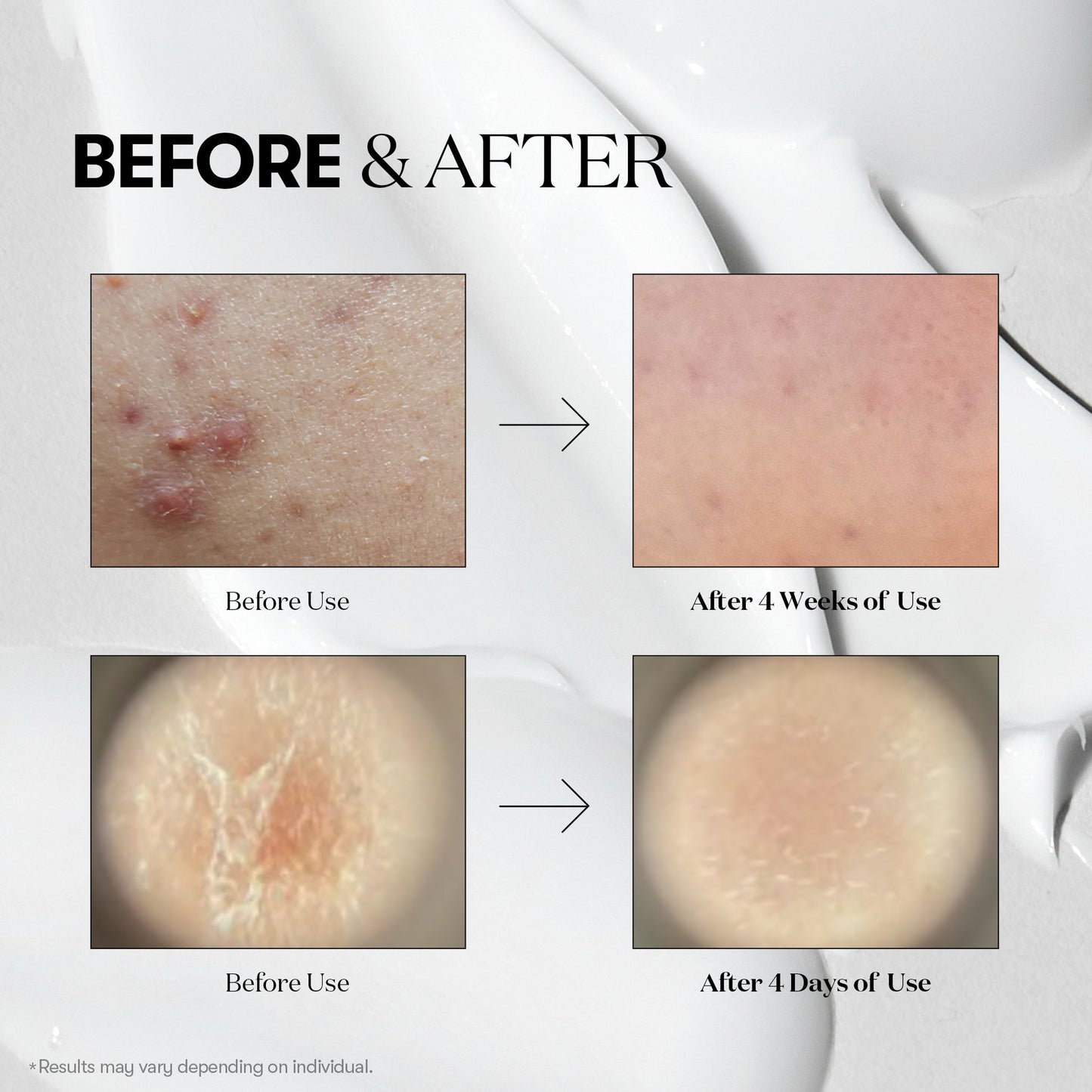 VT Cosmetics - Reedle Shot 100