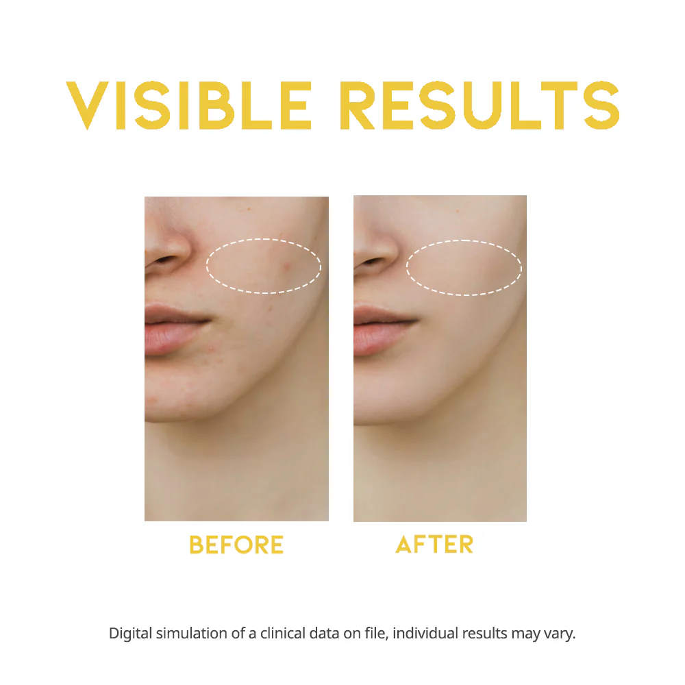 OOTD – Dark Spot Vitamin C Serum (50 ml)