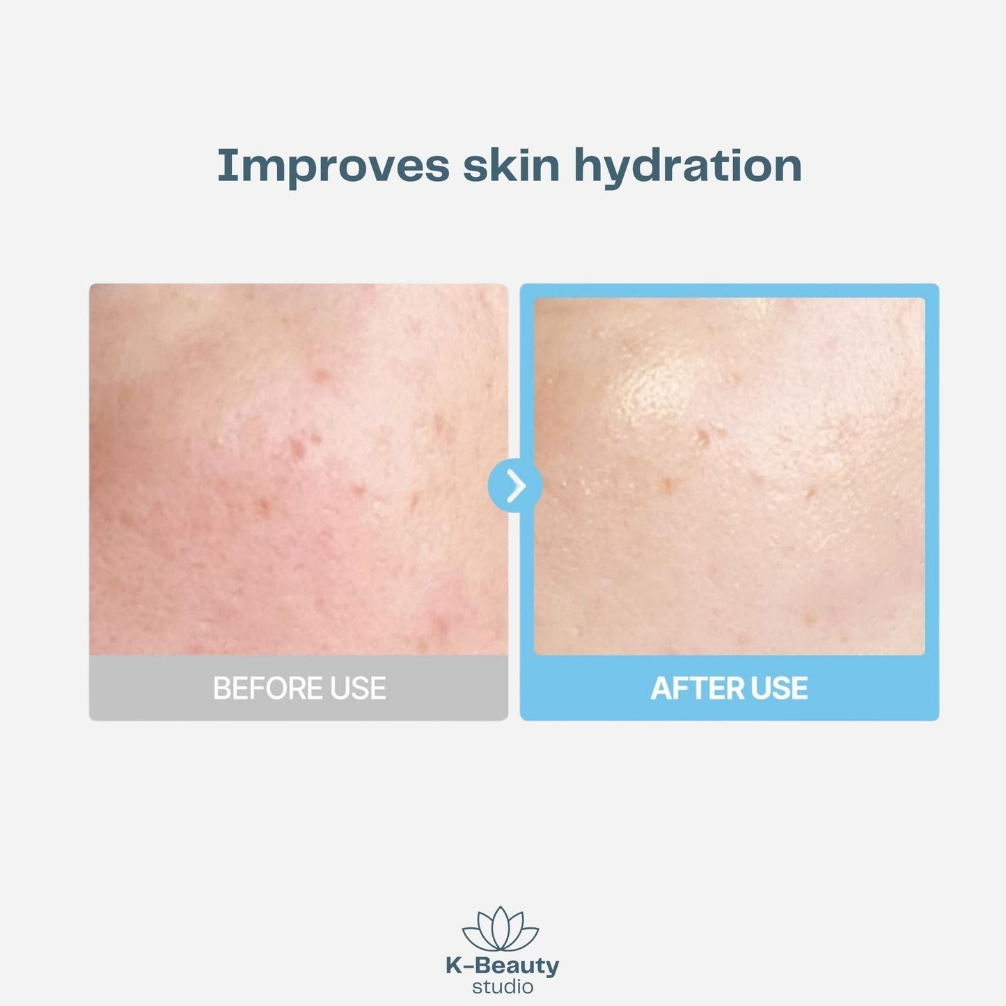 Torriden - Dive-In Low Molecule Hyaluronic Acid Multi Pad