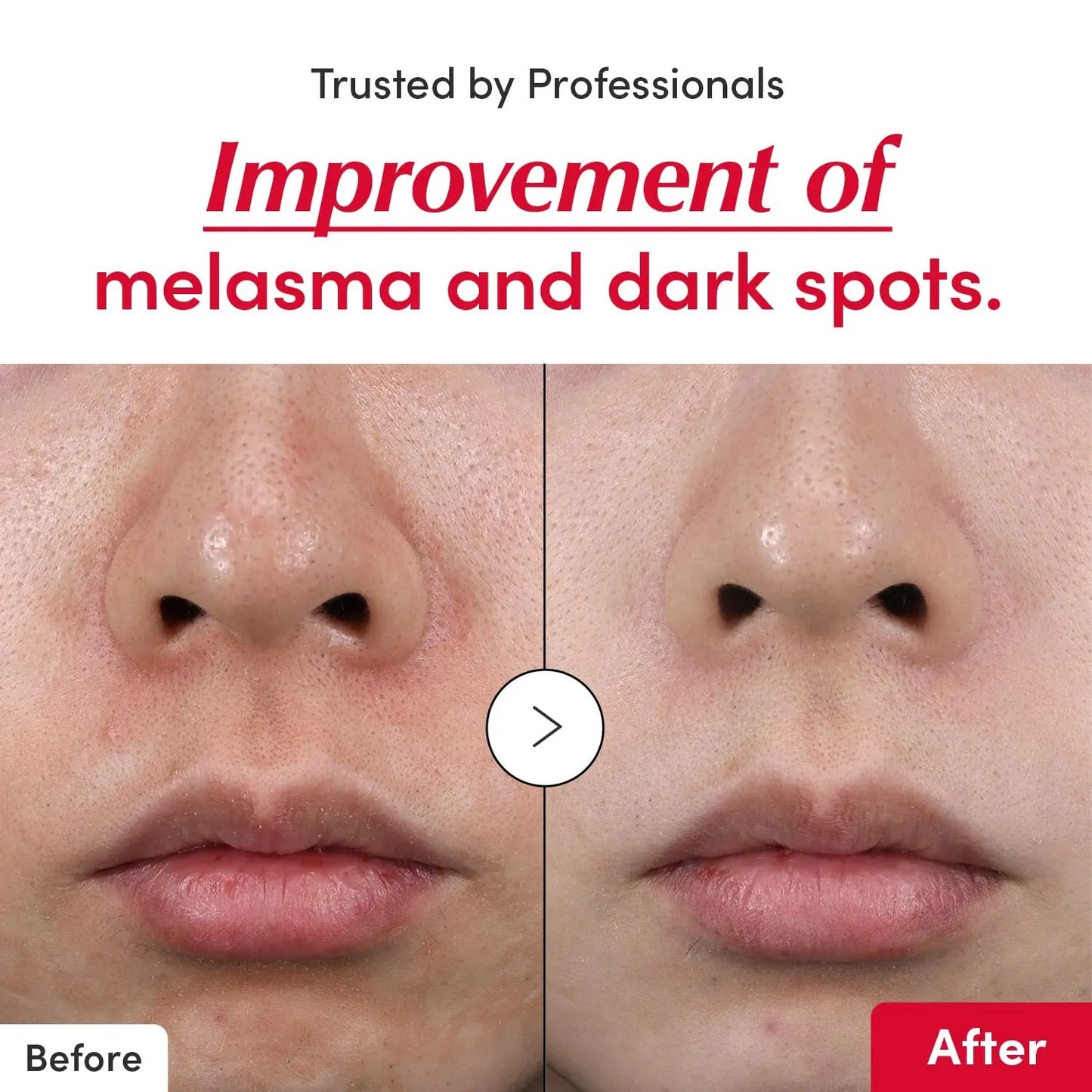 Eqqualberry – Vitamin Illuminating Serum