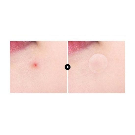 VT – Pro Cica Centella Asiatica Tiger Clear Spot Patch