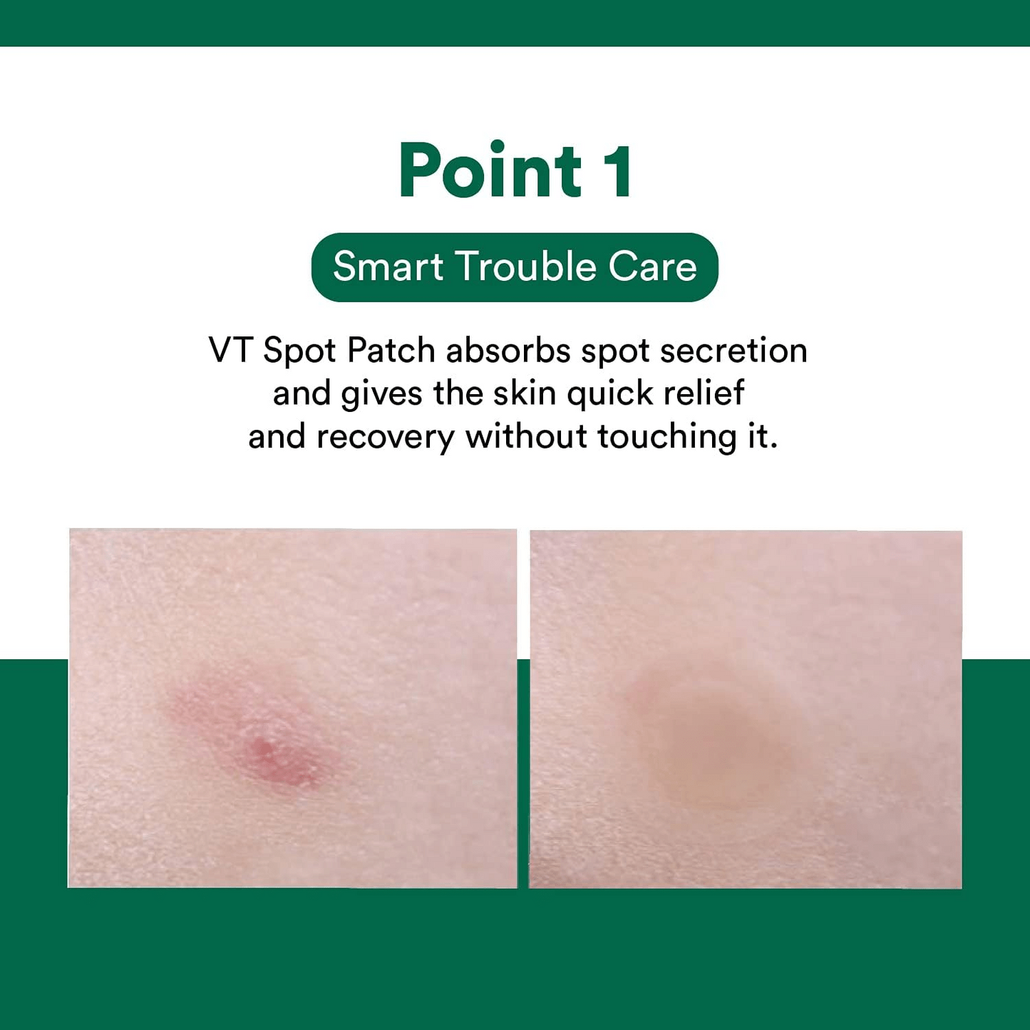 VT Cosmetics – Spot Patch (48ea)